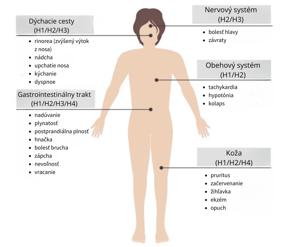 Hlavné príznaky HIT a pravdepodobne zodpovedajúce histamínové receptory. Prebrané z [5]