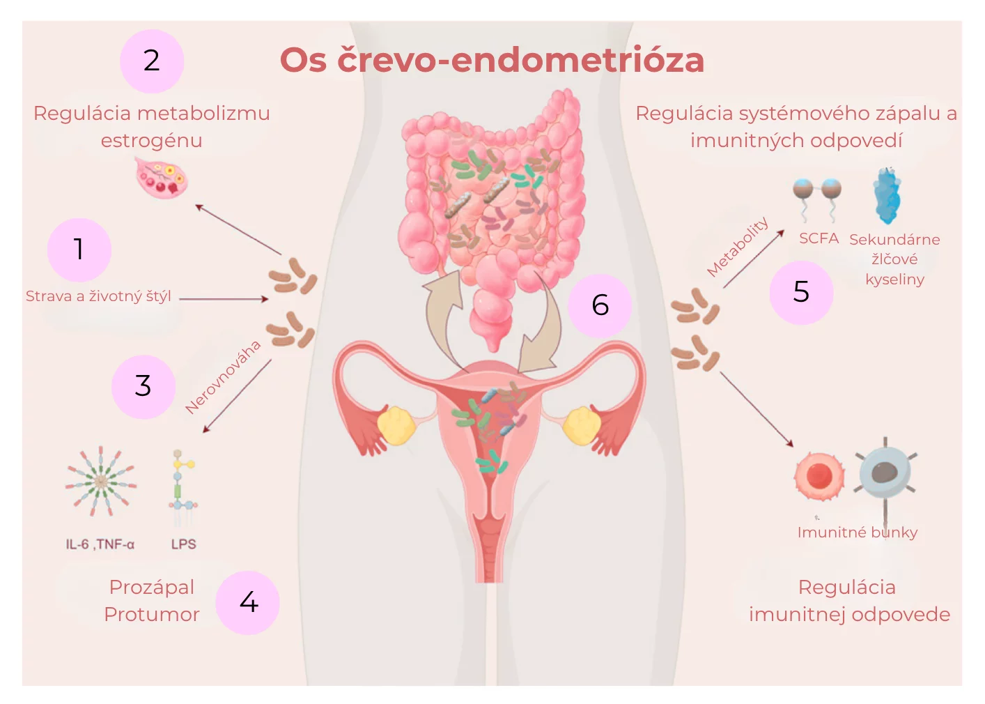 os črevo-endometrióza