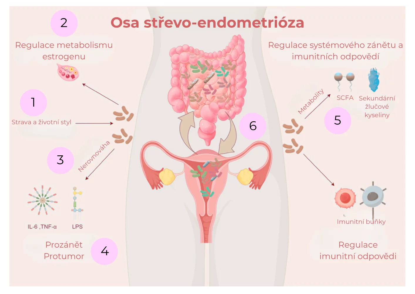 osa střevo-endometrióza