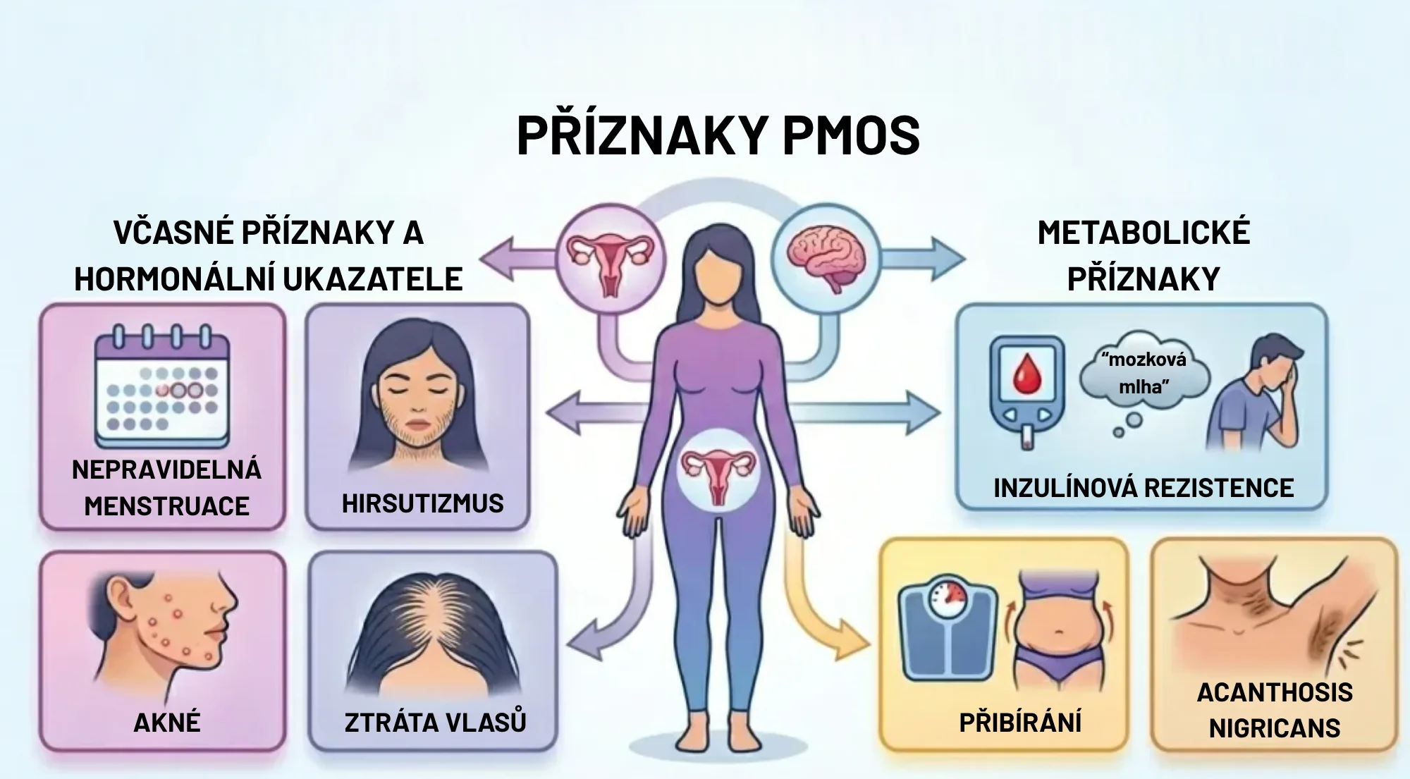 Typické příznaky PCOS (PMOS) u žen – nepravidelný cyklus, akné, hirsutismus a přibývání na váze